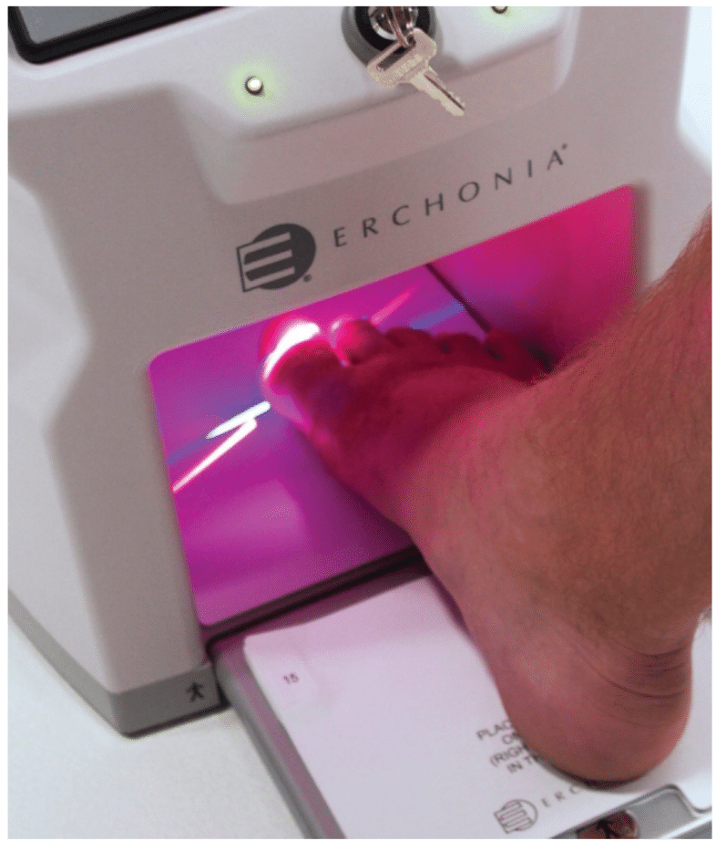Lunula Laser Webinar
